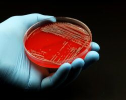 Doctor's or scientist's glove with a Petri dish with Agar Blood medium with a culture of the bacteria Methicillin resistant Staphylococcus aureus (MRSA)